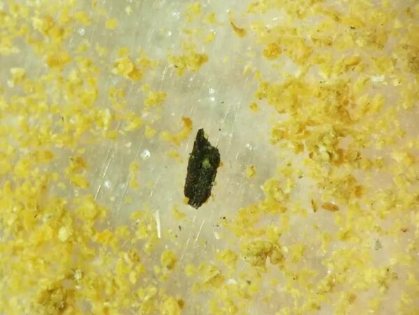 Крупный план кожи с желтыми чешуйками, возможно, дерматологическая проблема.