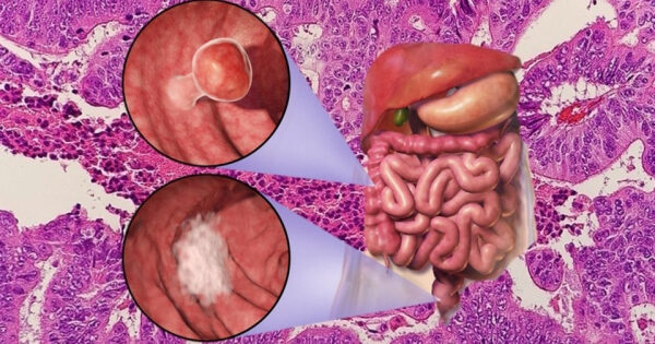 Человеческий кишечник и микроскопическая структура тканей с внутренними деталями.