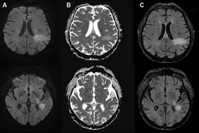 Вероятно, вы уже заражены вирусом, пожирающим мозг, о котором вы никогда не слышали.