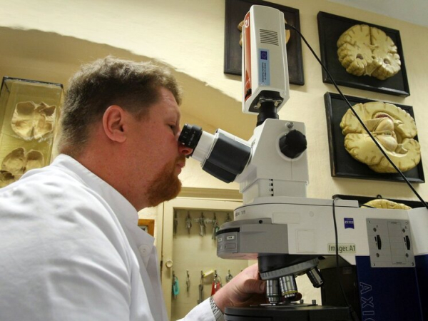 Ученые нашли вещество, побеждающее агрессию при болезни Альцгеймера