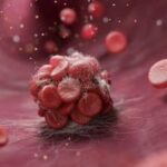 Компания E2 привлекла 80 миллионов долларов для продвижения коммерциализации системы лечения венозной тромбоэмболии — Medical Device Network