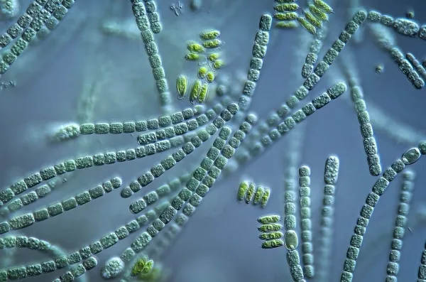 Клетки цианобактерий выстраиваются в ряд, как бусинки в ожерелье.