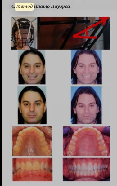 75fb2195cc096cfff0fedb8846393e78