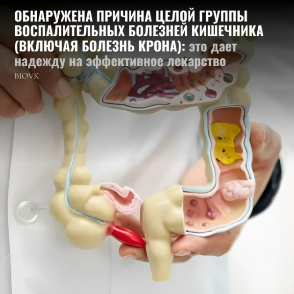 Почти полвека медики ломали голову, почему у людей с болезнью Крона и язвенным колитом иммунитет вдруг начинает атаковать собственный кишечник