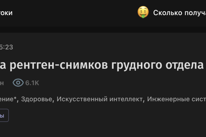 ИИ для анализа рентген‑снимков грудного отдела