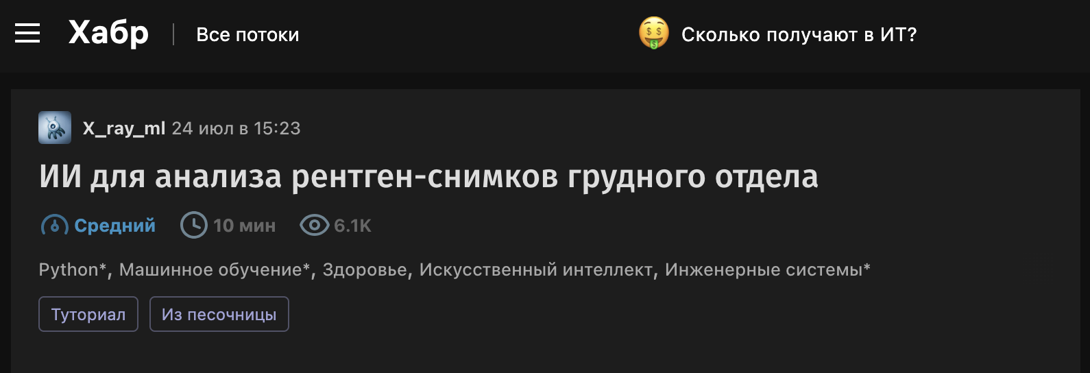 ИИ для анализа рентген‑снимков грудного отдела
