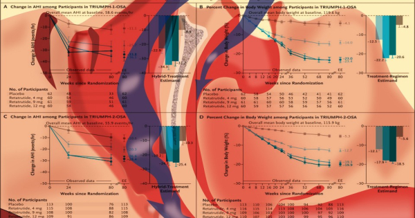 Ретатрутид снизил частоту обструктивных апноэ во сне при избытке массы тела. Результаты получены в испытаниях третьей фазы